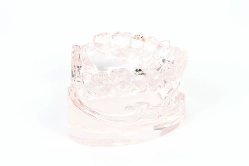 Teilkronen Keramik Gold NEM